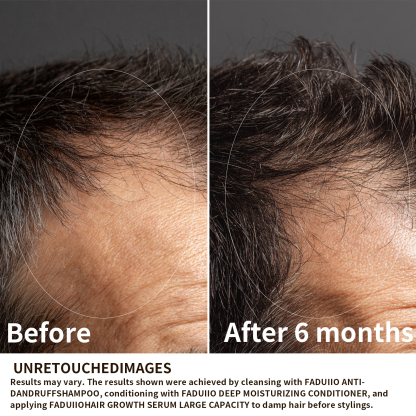 FADUIIO Hair Growth Serum with DAPO Biotin, Peptides, Caffeine & Ginseng – Daily Leave-In Treatment for Thinning Hair – Lightweight Formula for Visibly Thicker, Healthier-Looking Hair – 2 Fl Oz