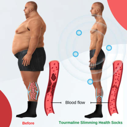 (🔥Last Day Promotion🔥- SAVE 48% OFF) Tourmaline Lymphvity Slimming Health Sock
