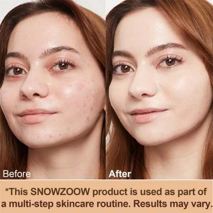 🔥Last Day Sale 49% OFF🎁 Foundation 4 in 1 - Light Spectrum