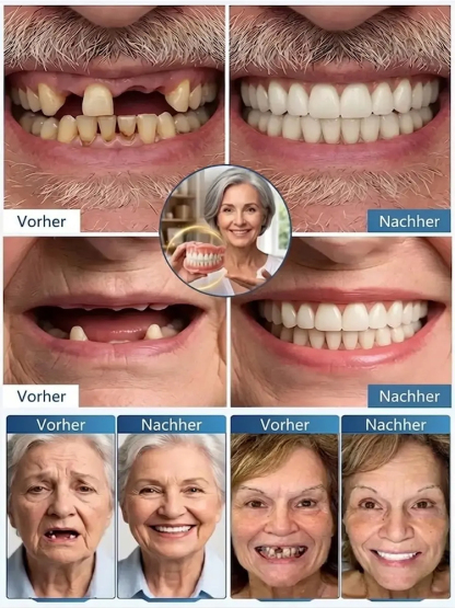 🦷【Revolutionäre Prothesen】Ihr perfektes Lächeln in nur 3 Sekunden – ganz bequem von zu Hause aus! 🛡️Hält bis zu 50 Jahre. 1 kaufen, 1 gratis!