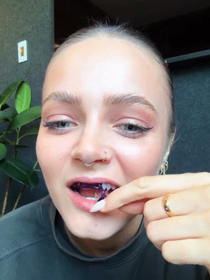 【TikTok Viral Secret】V34 Purple Strips | Instant Color Correction | Pearl White Smile ✨30-Min Results ✨