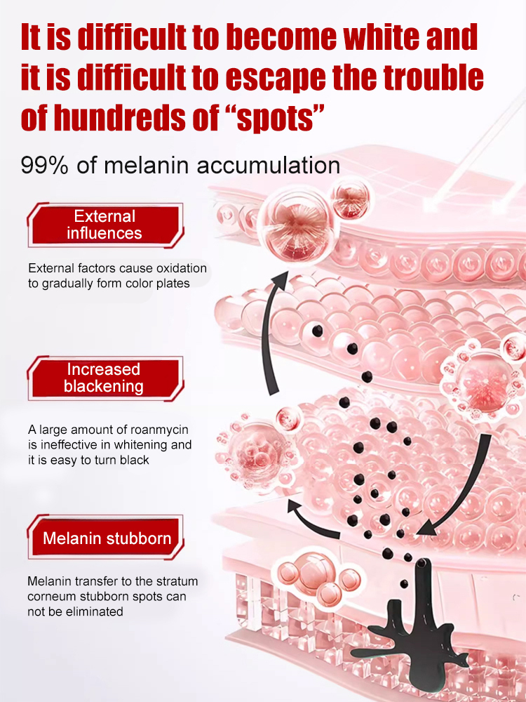 【All kinds of spots can be removed with one spray】Blemish removal, whitening and beauty water