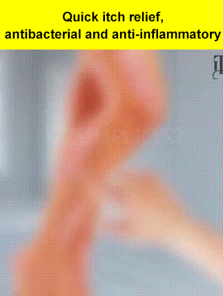 Miao pure herbal antipruritic and antibacterial cream