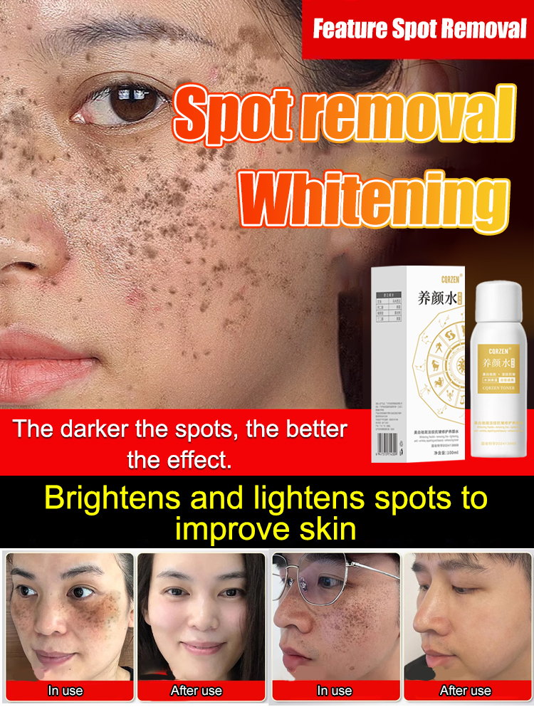 【All kinds of spots can be removed with one spray】Blemish removal, whitening and beauty water