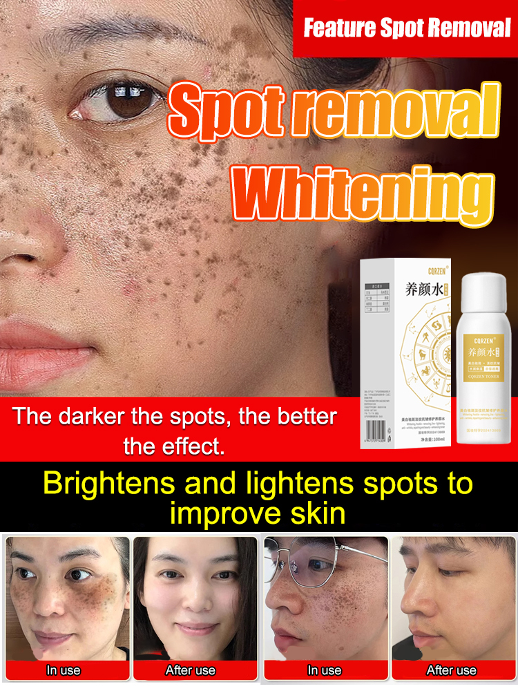 【All kinds of spots can be removed with one spray】Blemish removal, whitening and beauty water