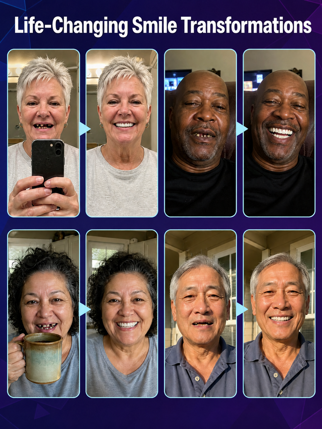 [Show Off Your Confident Smile] Full Set of Upper and Lower Dentures