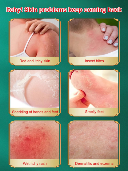 Miao pure herbal antipruritic and antibacterial cream