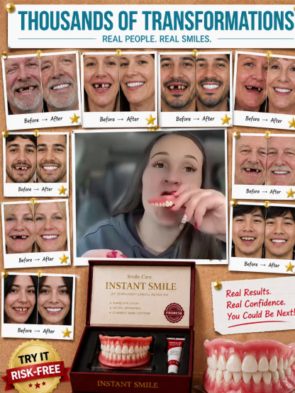 [Show Off Your Confident Smile] Full Set of Upper and Lower Dentures