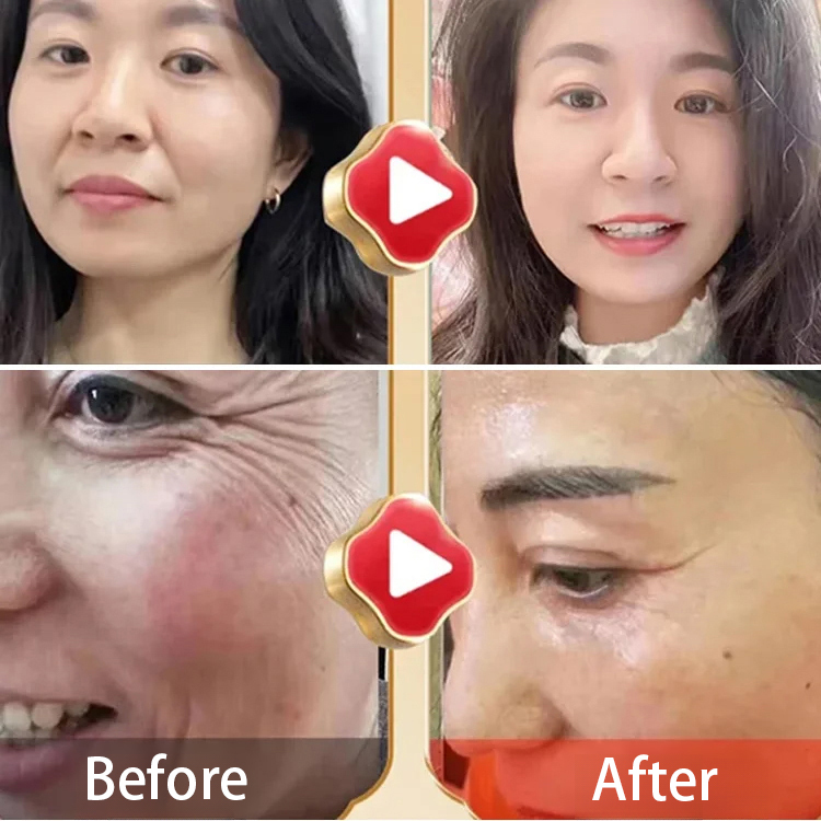 【Instant Wrinkle Eraser】Hydrating Anti-Aging Mist