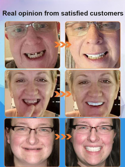 Silicone Simulation Teeth Braces