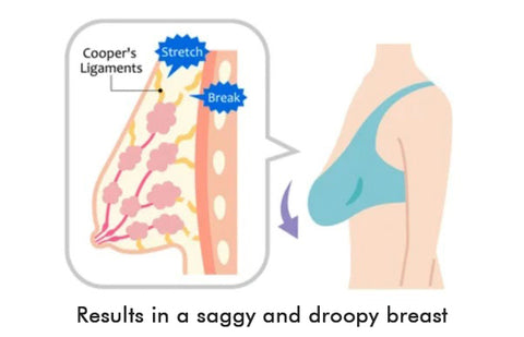 Podprsenka Oveallgo&trade; Lymphvity Detoxik&aacute;cia, tvarovanie a siln&yacute; lifting