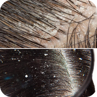 Scalp issues