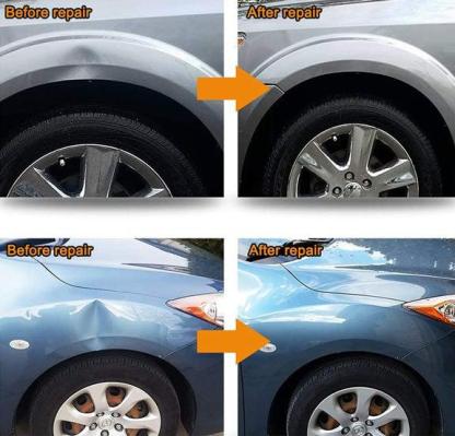 🚗🔥Paintless Dent Repair Kit