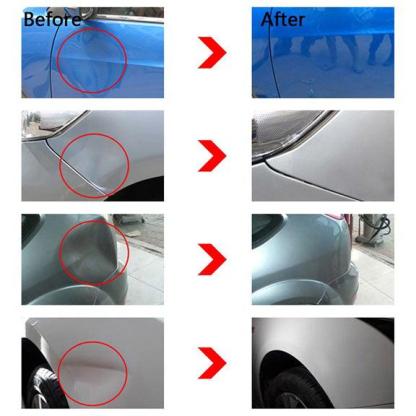 🚗🔥Paintless Dent Repair Kit