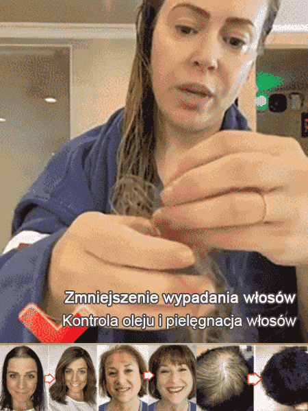 【Na wypadanie i łamliwość włosów】Gorąca sprzedaż Szampon przeciw wypadaniu włosów z ekstraktem z imbiru✨Japońska receptura ziołowa, włosy stają się bardziej gęste