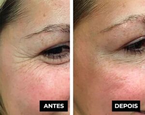 Lifting Firming Cream – Wrinkle Remover in 120 Seconds!