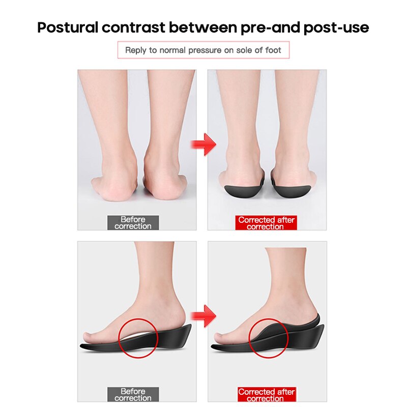 Arch Support Plantar Fasciitis Shoes Orthopedic Insoles For Flat Feet