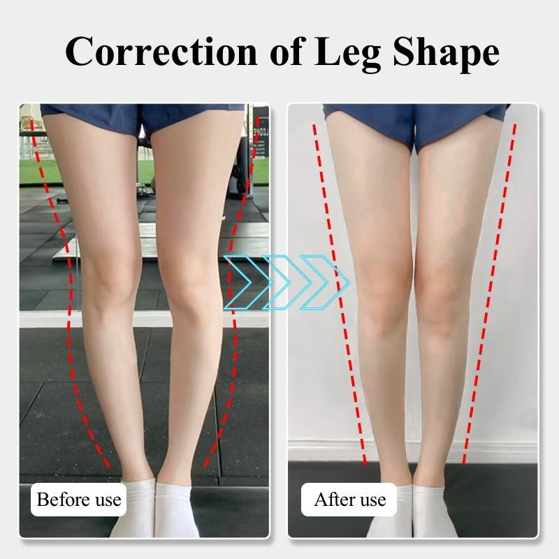 Magnets Silicon Orthopedic Insoles, O/X Type Legs Knee Varus Correction Heel Pads