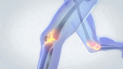 image_17.gif