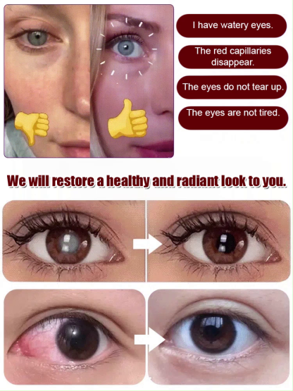 [Retina Recovery]Premium Wild Blueberry and Walnut Superfood Bites | Rich in Anthocyanins and Omega-3 🫐🧠