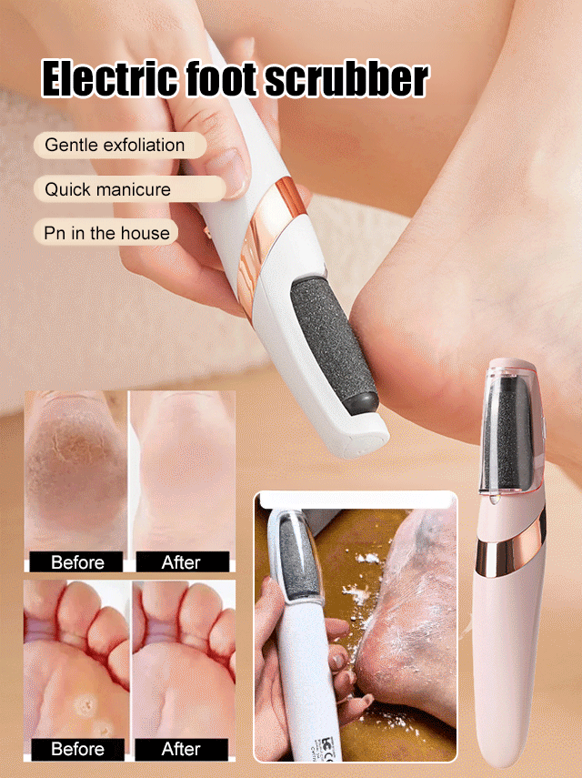 Remove Cracked Skin in 60 Seconds. See dead skin disappear! Professional callus remover for smooth heels.