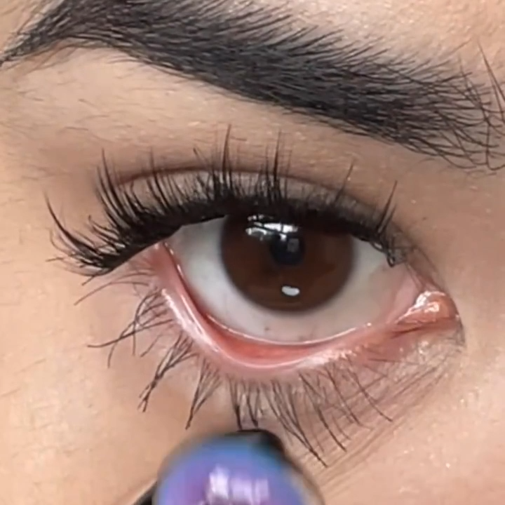 Akiwaii Medis Purple [Yearly]