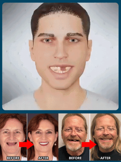  AI-Adapted 3D Veneers: FDA-Grade & Ultra-Thin Fit ✨ Instant Smile Makeover (No Dentist Needed) ✅ $39 Buy 1 Get 1 Free + 7-Day Risk-Free Trial