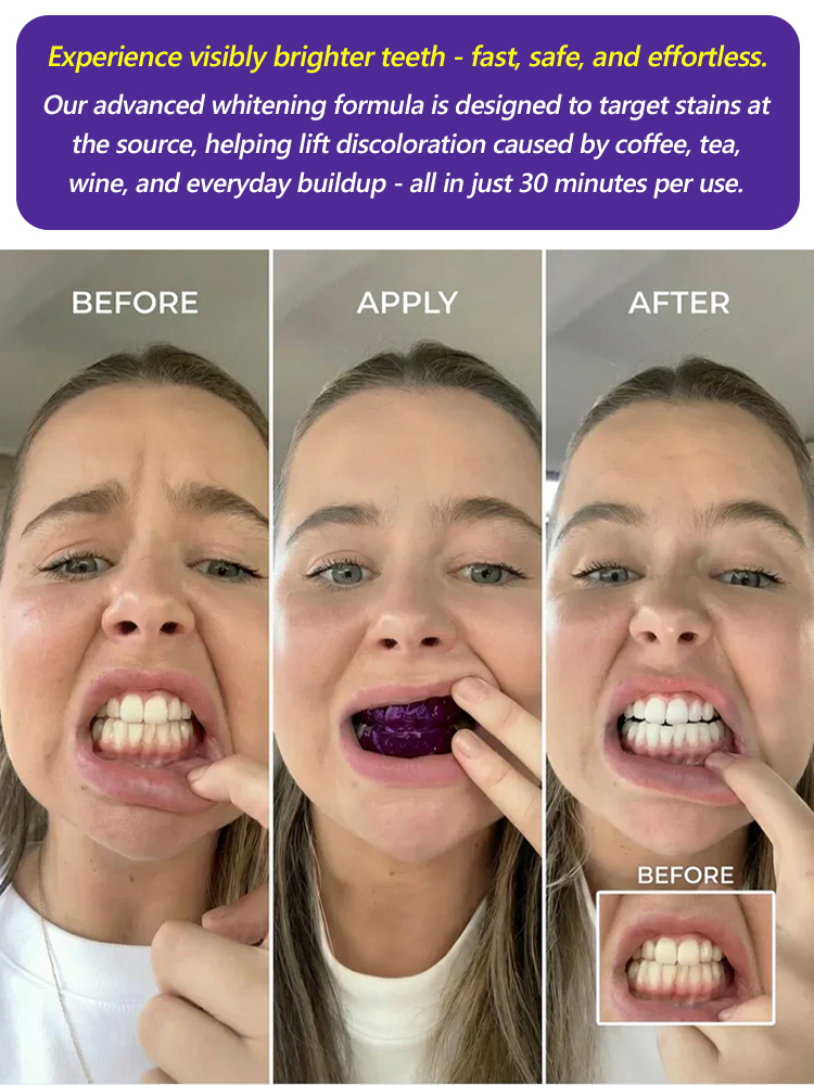 Purple Magic 💜 Watch Yellow Teeth Turn White Instantly with Color Correcting Strips! Whiter Teeth Without the Pain! 🦷 Testing Enamel-Safe Strips for Sensitive Teeth.