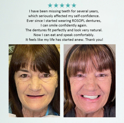 【All-Inclusive Customisation Package】Denture Care and Enhancement Kit