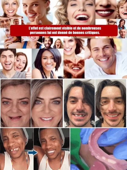 Porté en une seconde, aussi confortable que de vraies dents, Essayez-le gratuitement pendant 15 jours!
