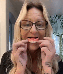 牙套42025102210285163.gif
