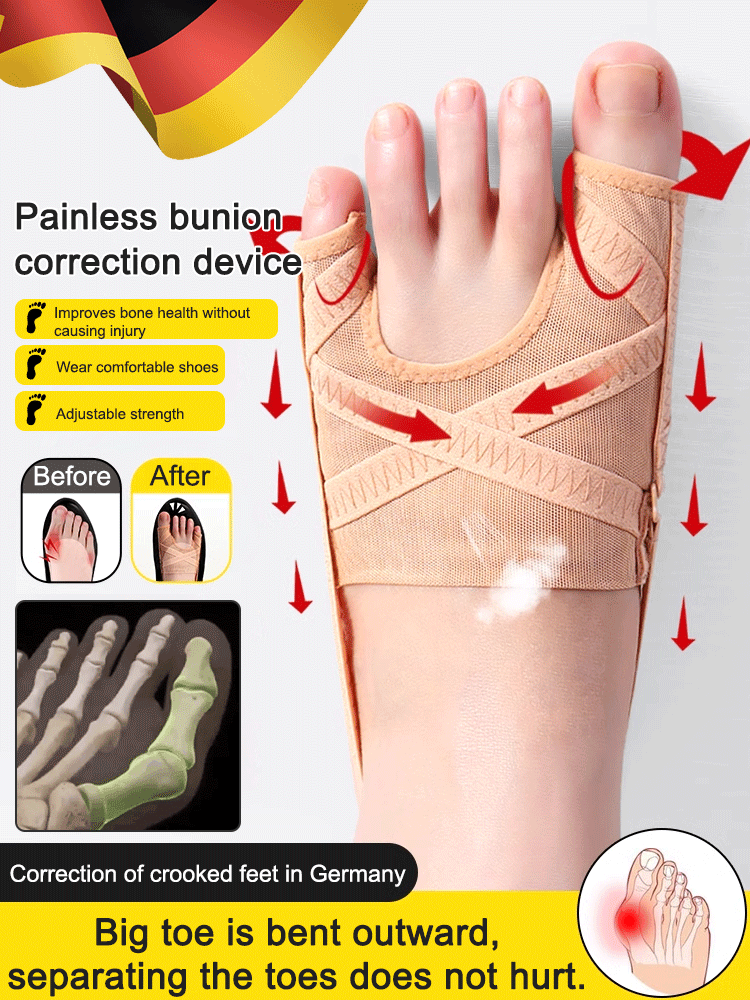 【80% off sale⏰last day❗】Mesh Hallux Valgus Big Toe Orthosis
