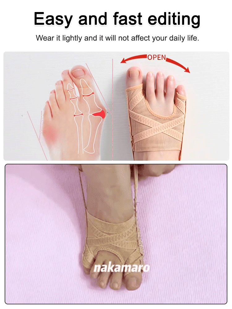 【80% off sale⏰last day❗】Mesh Hallux Valgus Big Toe Orthosis