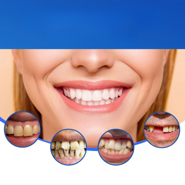【FDA & BDA Dual-Certified Realistic Denture Set】Wear for Life, No Replacement Needed!