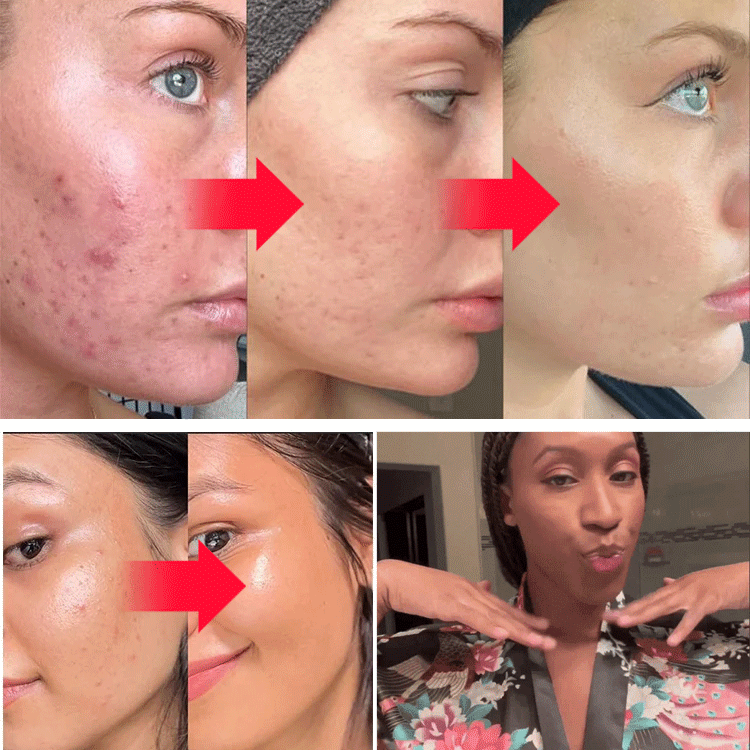 🧼 Say goodbye to dull and dry skin! Turmeric and Kojic Acid Soap 🌿 for both face and body 🌟 Nourishing and brightening in one step!