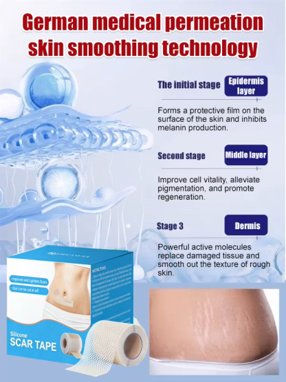 🏥German Medical-Grade Scar Fading Patches! Completely Eliminates Stretch Marks/C-Section Scars🌈