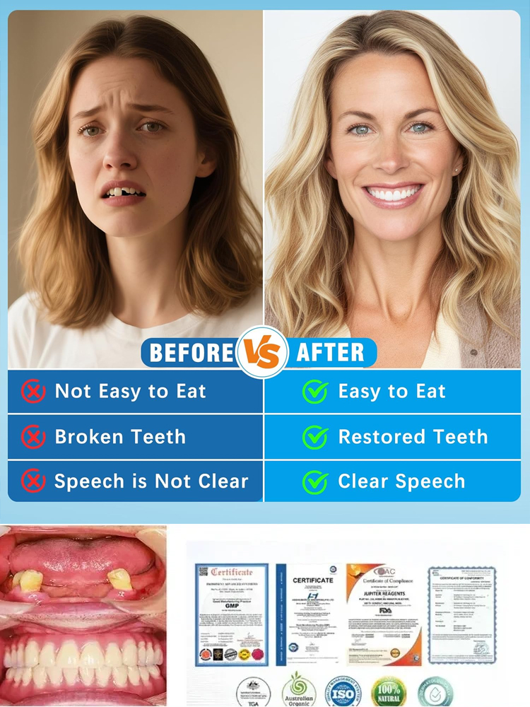 【🦷Buy One Get One Free】😻Say Goodbye to Toothache Embarrassment, Regain a Sparkling Smile in 3 Minutes😁Your Instant Smile Solution