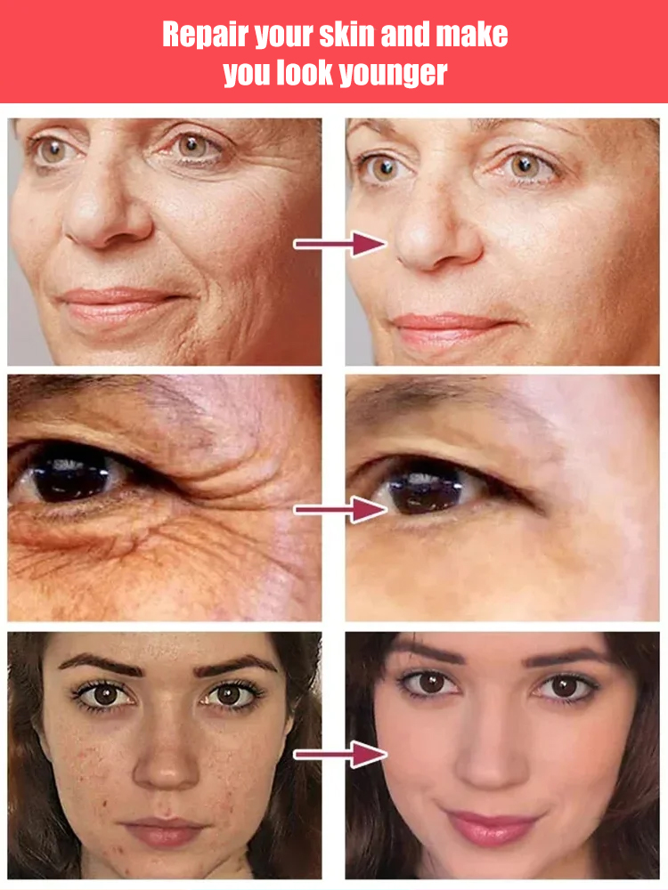 [🎉Buy One Get One Free] 💥Wrinkle Eraser 🧴Cell Rebuilding Collagen Serum, precisely reduces fine lines!🌟