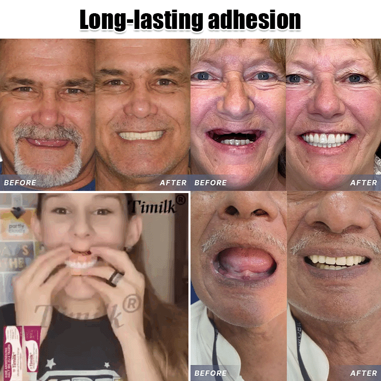 Feimuko denture fixing adhesive