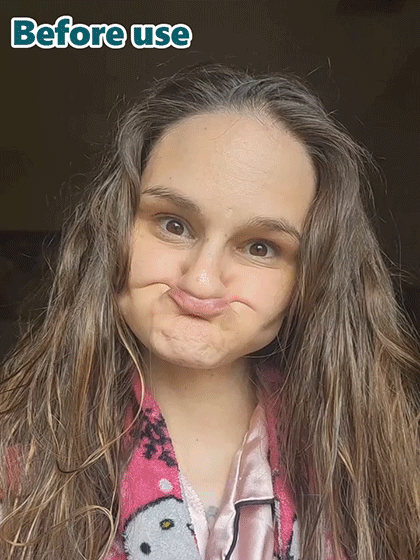 【FDA Certified】✨ Perfectly Fitting Custom-Made Dentures,Invisible and Natural, Corrects Misalignment✅