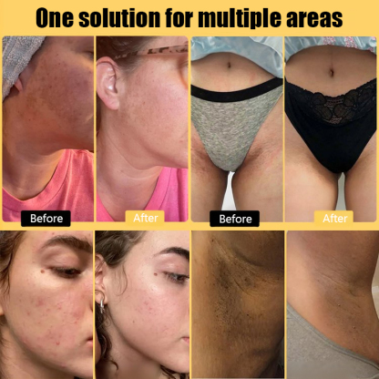 🧼 Say goodbye to dull and dry skin! Turmeric and Kojic Acid Soap 🌿 for both face and body 🌟 Nourishing and brightening in one step!