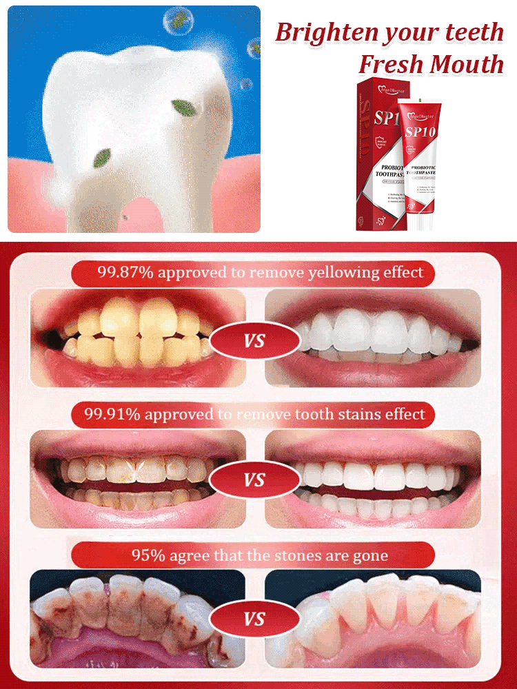 【🦷Buy One Get One Free】SP10 Probiotic Whitening Toothpaste ✨Gentle Whitening Without Damaging Teeth