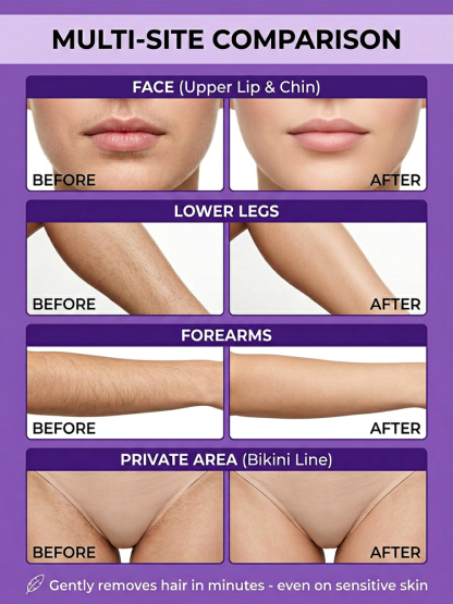 💫Long-lasting smooth hair removal cream, 97% non-irritating and leaves no dark spots, 2-in-1 hair removal and skin care