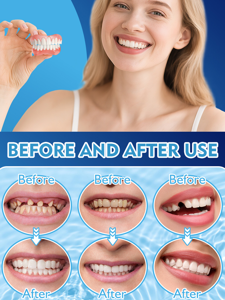 【🦷Buy One Get One Free】😻Say Goodbye to Toothache Embarrassment, Regain a Sparkling Smile in 3 Minutes😁Your Instant Smile Solution