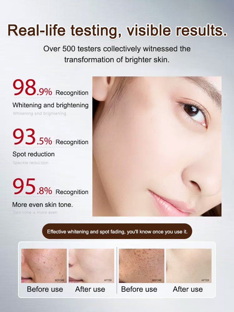 🤩Whitening and wrinkle-lightening cream, fades spots in 7 days✨️, deeply whitens in 28 days