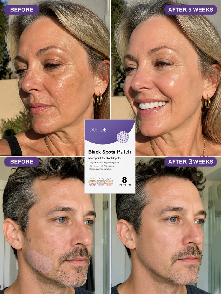 Facial Dark Spot Treatment Patches