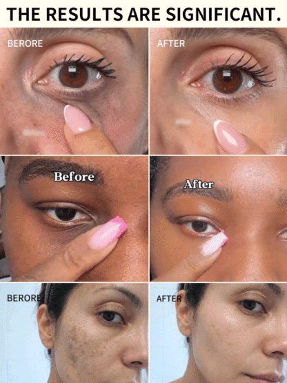 ✨ Transform Your Skin 11x Faster Than Retinol! 🧠 Dermatologist Approved Advanced Retinal Resurfacing Serum - Save 50% Today + 30-Day Risk-Free Trial! 🧪