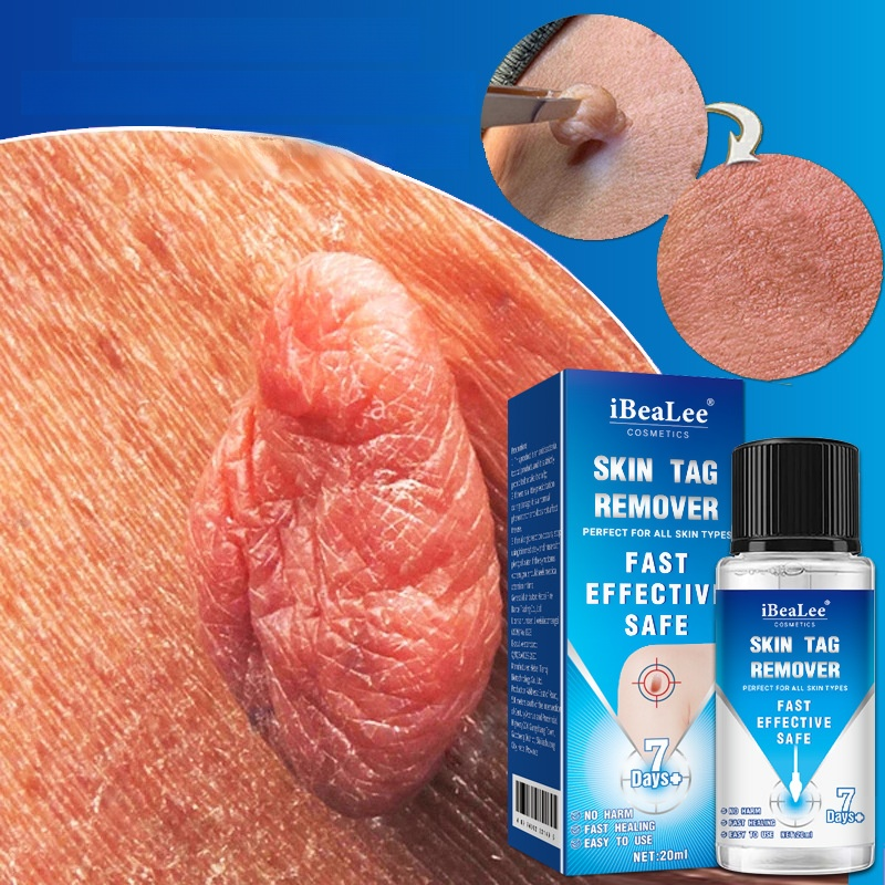 ✨Advanced Skin Tag & Wart Removal Essenceskin tags and warts without irritating the surrounding skin.