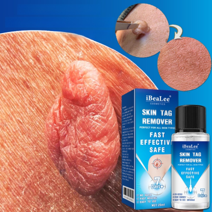 ✨Advanced Skin Tag & Wart Removal Essenceskin tags and warts without irritating the surrounding skin.