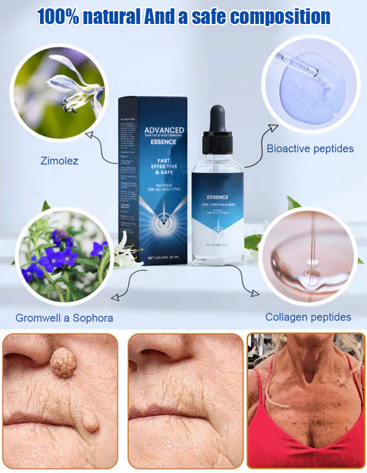 ✨Advanced Skin Tag & Wart Removal Essenceskin tags and warts without irritating the surrounding skin.